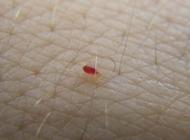 What Do Bed Bugs Look Like? - The Pest Advice